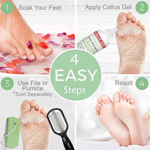 Dr. Entre's 16oz Callus Remover Gel: Extra Strength Value Size, Callus Remover for Feet, Pedicure Tools Supplies, Dead Skin Remover, Foot Care