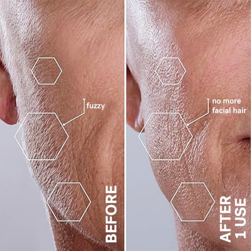 Michael Todd Beauty Sonicsmooth Pro+ Dermaplane Razor for Women Face + Eyebrow trimmer Dermaplaning System w/LED Light Peach Fuzz Remover -16 Dermaplaning Blades & 2 Microsmooth Exfoliation Tips