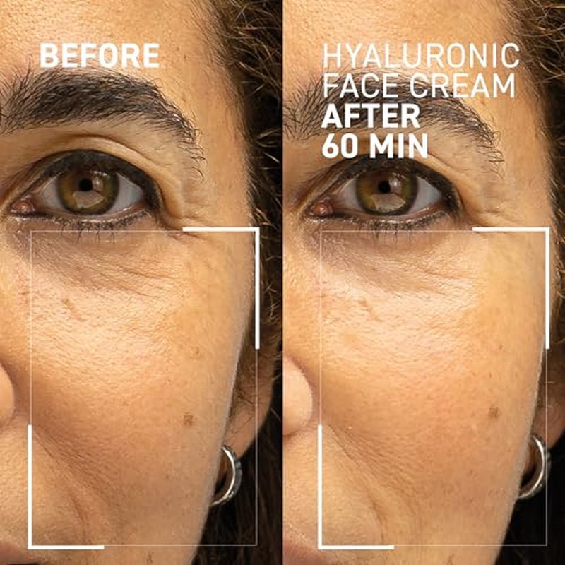 Dr. Brandt Needles No More Hyaluronic Face Cream - Long-Lasting Plumping Hydrator for Dehydrated & Dry Skin - 1.7 oz