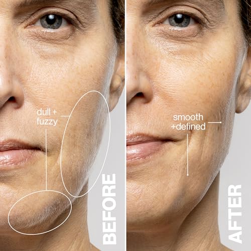 DERMAFLASH LUXE+ Sonic Dermaplaning Tool for Face Peach Fuzz Removal, Anti-Aging and Exfoliation, Pop Pink