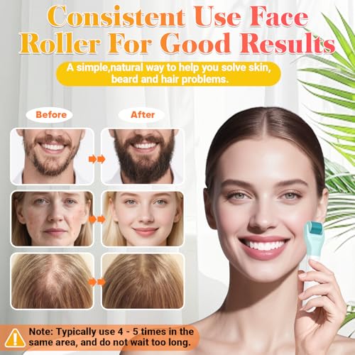 Derma Roller Set - UUPAS 10 in 1 Microneedling Roller Kit for Face, Body, Hair, Beard and Scalp - Ice Face Rollers for Women and Men with Storage Case