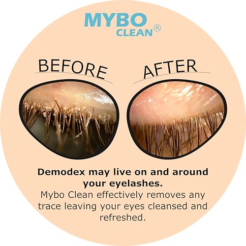 Mybo Clean Eyelid Cleansing Brush for Sensitive Skin (1 Pc) + Hydrating Lids and Lash Cleansing Gel (1Pc) + Travel Bag Ideal for Gentle Cleansing of the Eyelids On the Go