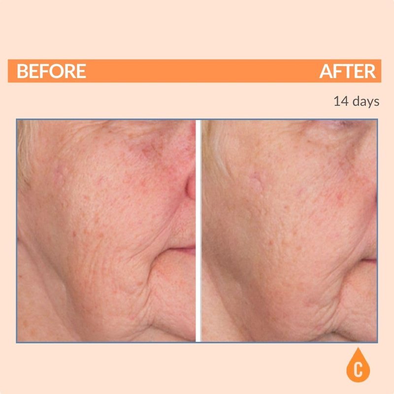 Serious Skincare Vitamin C Serum for Face, Anti-Aging Face Serum with Collagen, Vitamin E, Hydrating Skin Care for Brightening, Improve Appearance of Dark Spots, Tone, Fine Lines & Wrinkles 1 Fl Oz