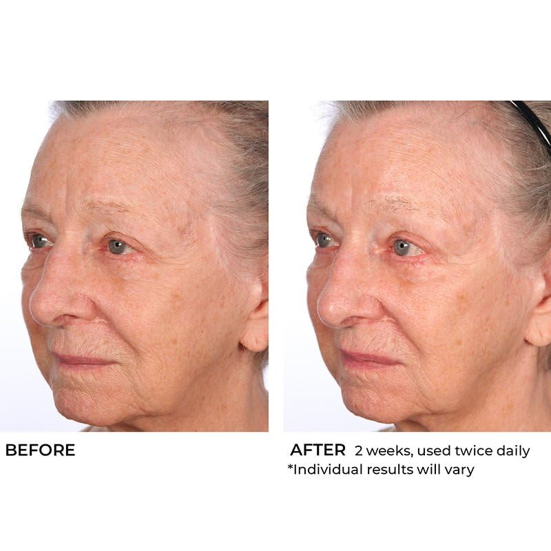 Hydro-Screen Intense Hydration Face & Body Souffle - Nourishing Moisturizer for All Skin Types