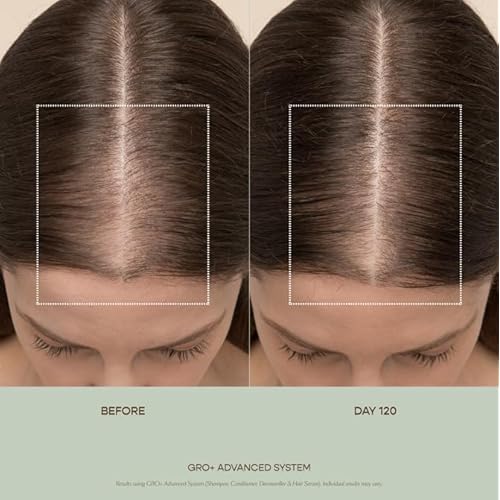 VEGAMOUR GRO+ Advanced Balancing Conditioner | Hydrates the Scalp, Nourishes and Softens Hair | For Severe Signs of Thinning | Color Safe, Vegan, Cruelty-Free, Formulated Without Silicones (8 Fl Oz)