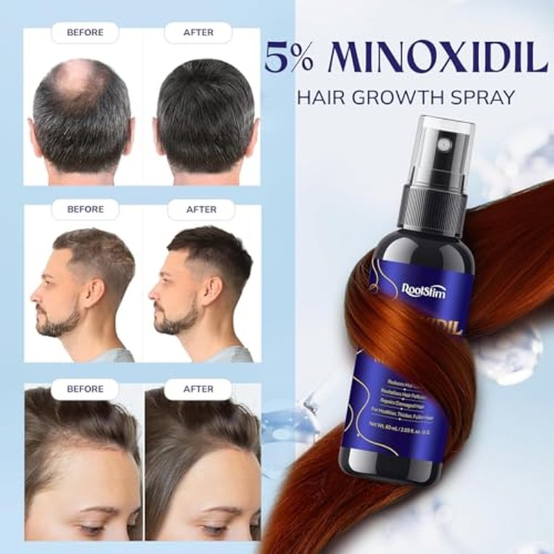 5% Minoxidil Kit for Men and Women ? 3-Pack Beard Growth Kit & Hair Regrowth Spray ? Targets Thinning Hairlines, Crowns & Patchy Beards ? 180 mL