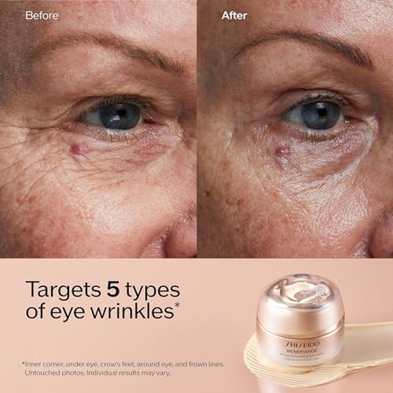 Shiseido Benefiance Wrinkle Smoothing Eye Cream - 15 mL - Visibly Improves Five Types of Eye Wrinkles, Dark Circles & Puffiness - 48-HR Hydration - All Skin Types - Non-Comedogenic
