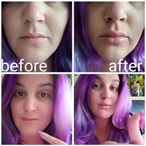 passi Lip Plumper Device | Fish Shape Lips Enhancer, Fish Lip Mouth Beauty Enhancer Device Fish Shape - Fuller Thicker Mouth Fastly Lip Pumps, Silicone Filler Plumper For Sexy Mouth, Natural Pout