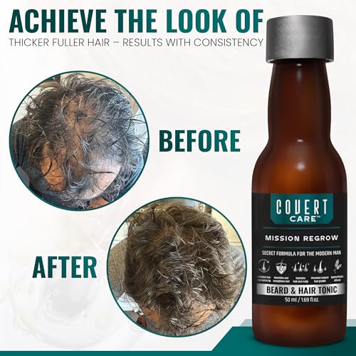 Hair and Beard Thickening Serum for Men ? Lightweight Root Activator for Thinning Hair, Scalp Nourishment for Fuller, Stronger-Looking Hair