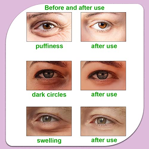 Hot and Cold Eye Pads, reusable eye patches - Soothing, Revitalizing, Puffiness, Refresh, Relieves Stress, Relax, Relieves Puffiness and Tension(2 watermelons + 2 cucumbers)