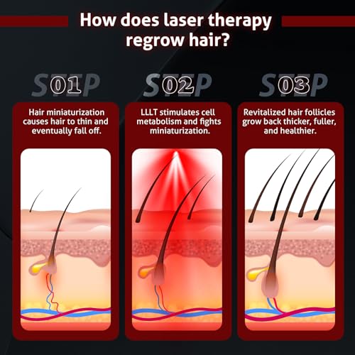 Laser Cap for Hair Growth, Wireless Red Light Therapy for Hair Growth, Strengthen Hair Roots, Hair Loss Treatment for Men and Women