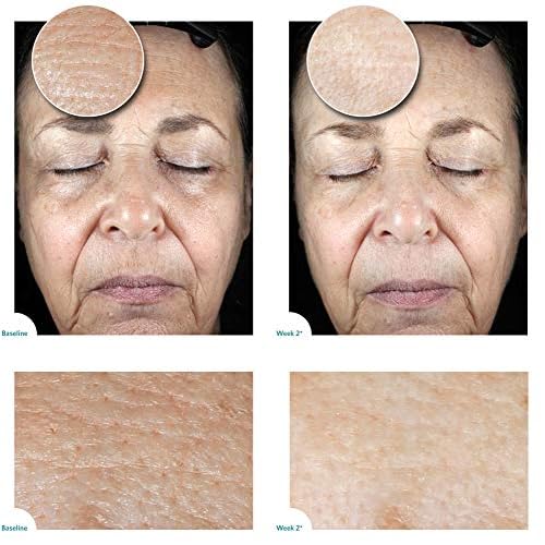 Satin Bright Soft Water Peel for Face , exfoliator for anti-aging, acne, dry, oily, sensitive skin, eczema , 95% organic/natural Korean peeling gel/gommage , large 100 ml/3.4 Fl Oz size