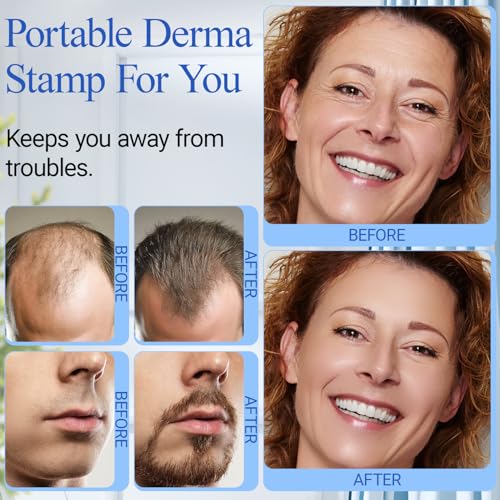 Derma Stamp - ANSIOVON Microneedling Stamp for Hair Face Scalp Beard - Microneedle Dermastamp at Home - Micro Needling Stamp for Women and Men