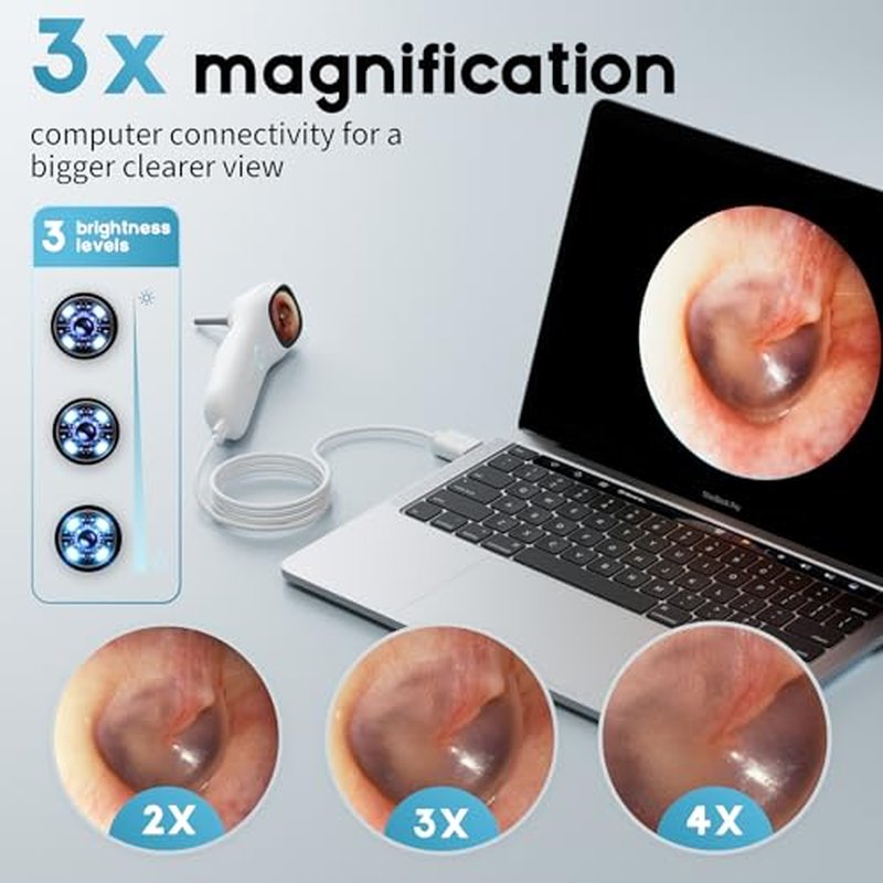 Otoscope Ear Camera with 1.21¡± Screen, 1080P HD Ear Scope with 4 LED Lights, Otoscope Camera for Adults Kids and Pets, Support Photo & Video, Type-C Charging with Computers, Baby Essentials