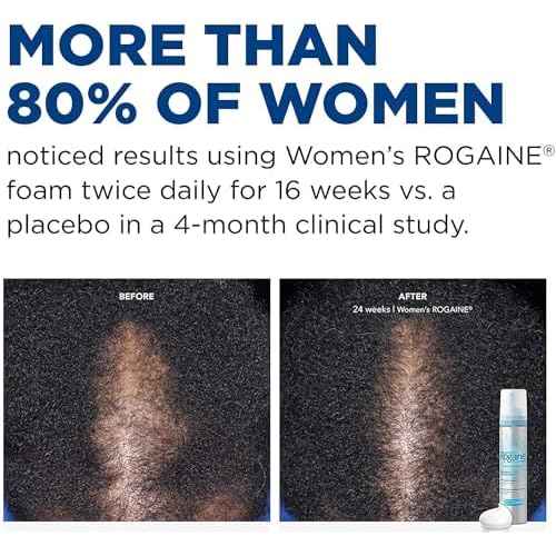 Rogaine 5% Minoxidil Foam, Topical Once-A-Day Hair Loss Treatment for Women to Regrow Fuller, Thicker Hair, Unscented, 2-Month Supply, 2.11 oz