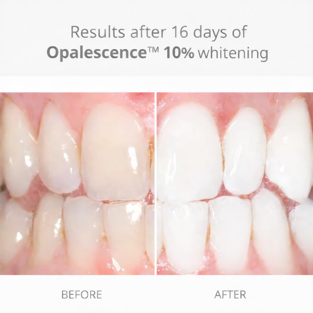 Opalescence 10% Teeth Whitening Gel Refill Syringes, (4CT) Melon 5395-2