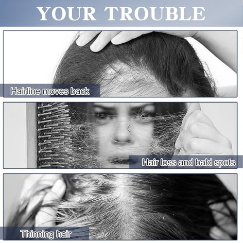 5% Minoxidil Hair growth Spray for Women and Men: Anti Hair Loss Treatment for Hair Regrowth 2 Month Supply, Extra Strength Scalp Solution, Thicken Strengthen Longer Hair