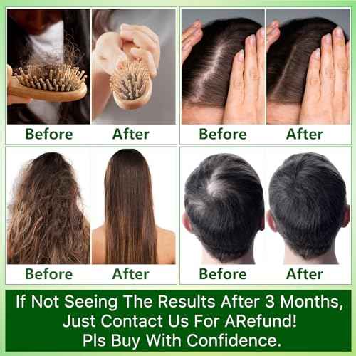 Hair Growth Shampoo and Conditioner Set w/Heat Protectant Spray,Rosemary Biotin Keratin Argan Oil Sulfate Free Routine Hair Growth Products for Thinning Hair & Hair Loss,Birthday Gifts for Women Men