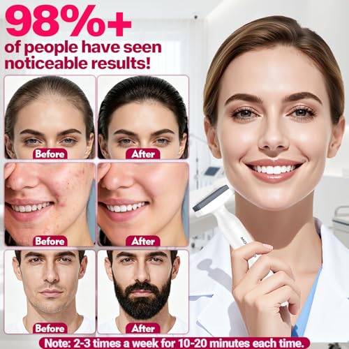 Derma Stamp, MONESAO Microneedling Stamp for Skin Face Hair Scalp Beard, Microneedle Dermastamp Tool with 2 Replacement Heads, Micro Needling Stamp Kit for Women and Men