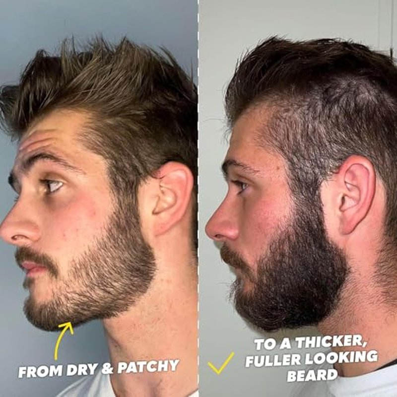 The Beard Club Titanium Beard Growth Kit - Derma Roller, Growth Oil, Vitamins, Vitamin Spray, Biotin Balm, Thickening Conditioner, Shampoo, Straight Razor, Scissors, Comb, Cleansing Spray - Gift Set