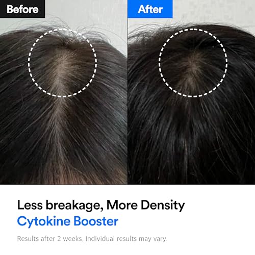 REFILLED Booster Plus Moisture | Hair Growth Serum & Thickening Scalp Treatment with Built-in Massager for Men & Women | Hair Loss & Thinning | Fuller & Baby Hair Regrowth | Fast-Absorbing with Biotin