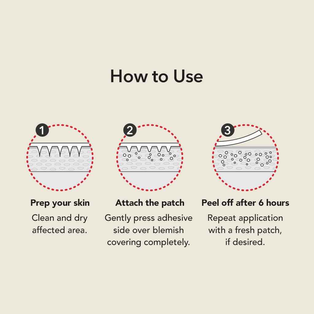 SKINBUILDERS Microdart Acne Patch, Pimple patch Microneedle, Acne Treatment, PimTox Acne Patches For Hormonal Acne And Blemishes, Zit Patches, Patented Microneedles 27EA, Micropoint Pimple Patch
