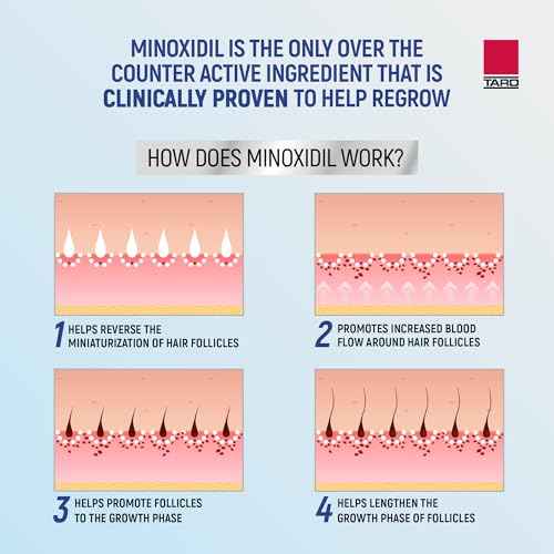 Taro Minoxidil for Men, 2.11 Oz (1 Month Supply) Clinically Proven to Regrow Hair, Topical Aerosol Foam 5%, Hair Thinning Treatment