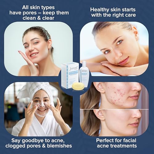JOESOEF SKIN CARE Sulfur Soap for Acne Pharmaceutical Grade Dermatologists Approved for Acne Rosacea. Sulfur Acne Treatment for Skin Care Daily Routine. (2pack)