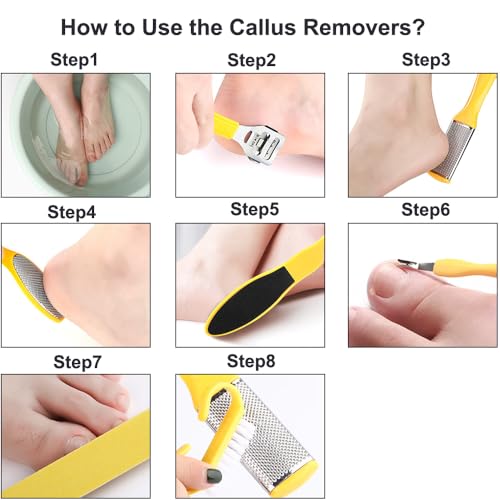 Stainless Callus Removers Set Foot File Pedicure Tools Kit for Feet Nail Clippers Set Fingernail Clipper Toenail Clipper Nail Care Tool with Travel Case for Men Women