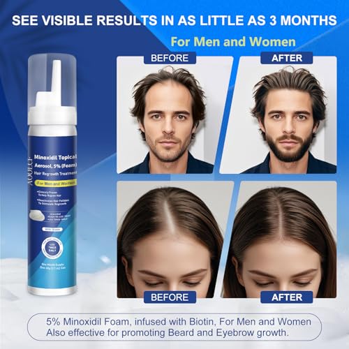 5% Topical Minoxidil Foam, Minoxidil for Men and Women, Infused with Biotin, Hair Growth Treatment, Supports Thicker and Fuller Hair & Beard (Minoxidil Foam, 6.33oz, 3 Month Supply)