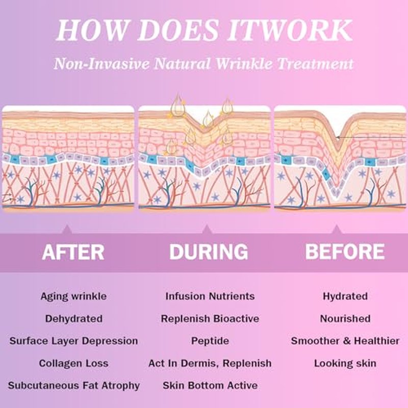Facial Wrinkle Patches,Anti Wrinkle Smoothing Strips,Set of Reusable Face Tape for Reducing Forehead Eye and Upper Lip Patches,All in One Treatment 208 Pcs
