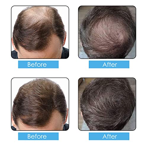 Hair Fibers Spray Refill Powder 100 Grams,Black,Thinning Fine Hair Loss Concealer,Undetected & Unscented,Refill Exsiting Shaker Bottle