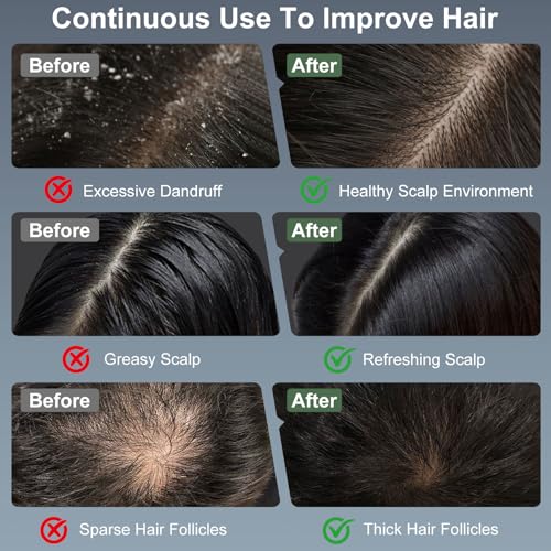 Laser Therapy Hair Growth Comb, Electric Scalp Massager, Handheld Comb-Shaped Hair Regrowth Device for Hair Growth & Hair Care for Thicker, Healthier Hair