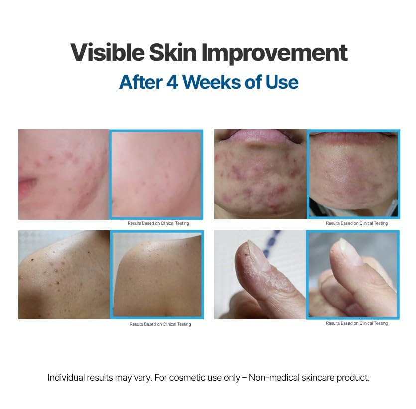 Pro-Resolving Cream - Anti-Aging Moisturizer for Radiant Skin | 1.7 oz