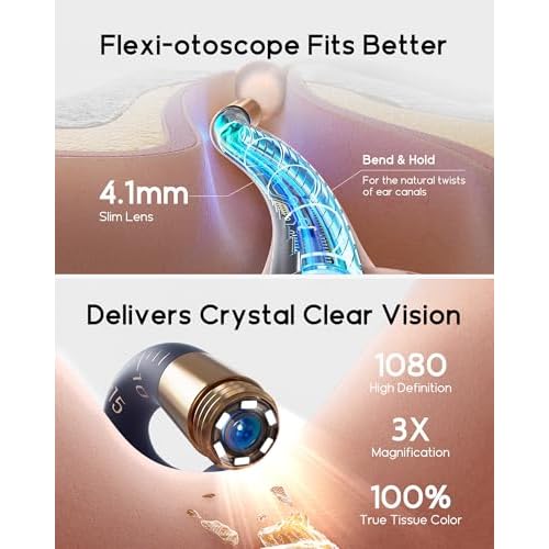 Earsight Plus I35R Ear Wax Removal Tool with Camera | Smart Visual Ear Cleaner with Gentle Tweezers & 12 Tips, HD Otoscope for Adults & Kids