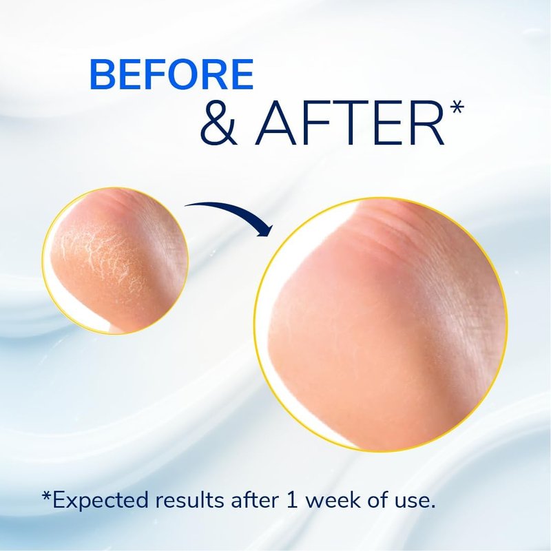 Dr. Scholl's Heel Repair Balm - 25% Urea for Cracked Feet | 2.5oz, Moisturizing & Soothing Epsom Salt, 3-Pack