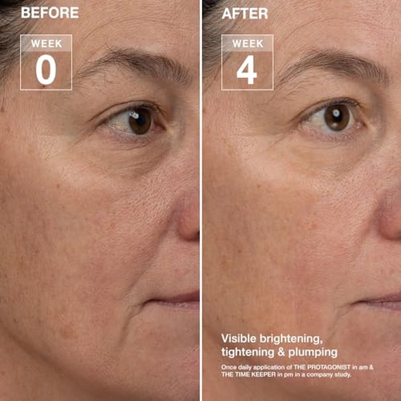 Day Night Duo 2 Piece Set, 5% Tranexamic Acid, Peptides, Ceramides, 5% Niacinamide, 1 Step AM PM, Serum + Moisturizer, for Face, Neck, Eyes