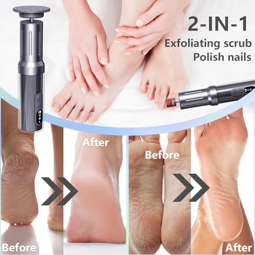 Electric Foot Callus Remover with Nano-Glass Head&Rechargeable Base,6 Speeds Cordless Electric Foot File with Digital Display,Callus Remover for Feet Dead Skin Home Spa Salon with 60Pcs Sandpaper Disk