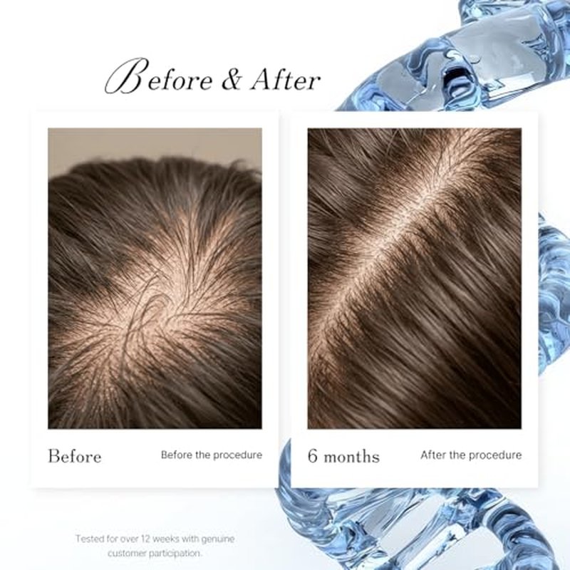 Dx2-Dixidox Anti Hair Loss Scalp Treatment 118ml | Root Strengthening | Anti-Shedding