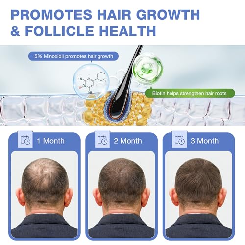 5% Minoxidil for Men, for Men & Women Hair with Biotin, Minoxidil for Beard Growth for Hair Loss to Hair Regrowth Get Thicker Fuller, Hair Loss Treatments for Women 100ml