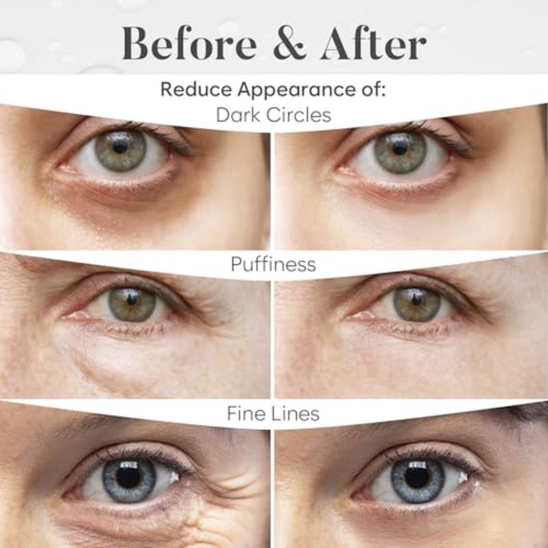 Variety Under Eye Patches (20 Pairs) - Dark Circles & Puffiness Care - Eye Mask for Care - 5 Varieties