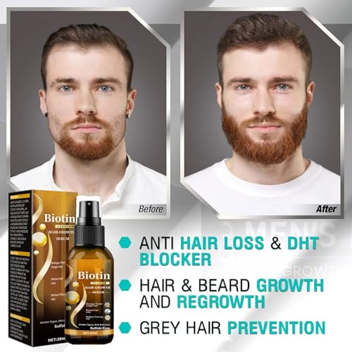 Biotin Hair Growth Serum£¬Hair Growth Spray Containing Ginseng Root Extract and Ginger Root Extract£¬Moisturizes the scalp, strengthens hair follicles, prevents hair loss, and promotes hair growth.