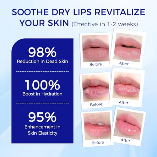 Medicated Lip Balm w/Organic & 100% Natural Ingredients, Squeeze Tube Lip Butter SPF 25+ Long-Lasting Moisturizing Overnight Lip Mask Gentle Exfoliation Extreme Dry Lips Treatment