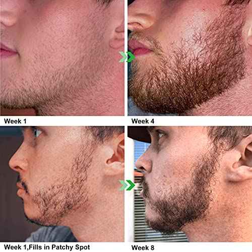 Beard Growth Kit, Beard Kit with Beard Growth Oil, Balm, Comb, Massager for Fuller & Stronger Beards, Birthday Gifts for Men Husband Dad Boyfriend