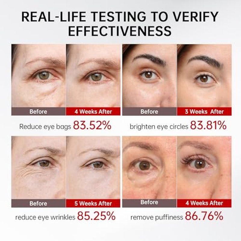 Retinol & Caffeine Eye Serum -360¡Æ Massage Roller for Puffiness,Eyebag Remover,Wrinkle Filler,Under Eye Cream For Dark Circles 0.54fl.oz (Pack of 1)