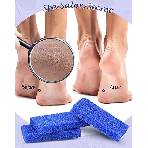 Maryton Disposable Foot Scrubber Pumice Pads, Pedicure Pumice Stone Dead Skin Callus Remover for Feet, 40Pcs (Dark Blue Coarse)