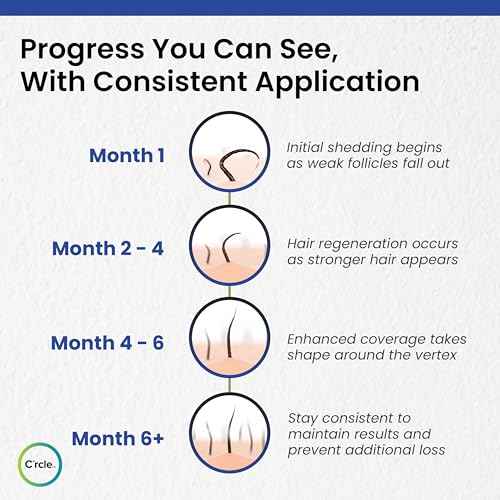Minoxidil for Men Foam 5% - Unscented 3 Month Supply - Helps Restore Vertex Hair Loss & Thinning - 5% Minoxidil Foam For Men - Extra Strength Supports Hair Regrowth