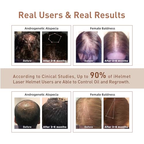 Laser Hair Growth System (FDA Cleared), Hair Regrowth Helmet & Laser Cap, Hair Loss Treatment for Men and Women, Low Level Laser Therapy for Hair Growth, Anti-Thining Treatment£¬36 Pink