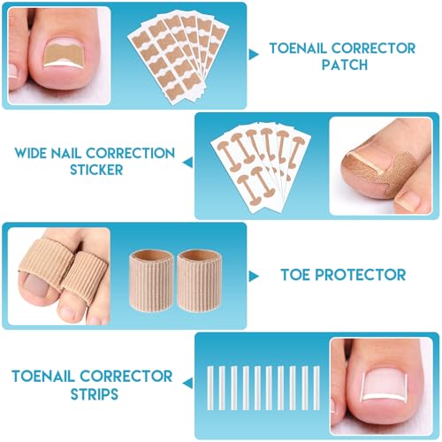 Ingrown Toenail Removal Kit, Professional Ingrown Toenail Tool Kit Includes Ingrown Toenail Corrector Drops, Corrector Patch, Toenail Clipper, Nail File Lifter Pedicure Tools