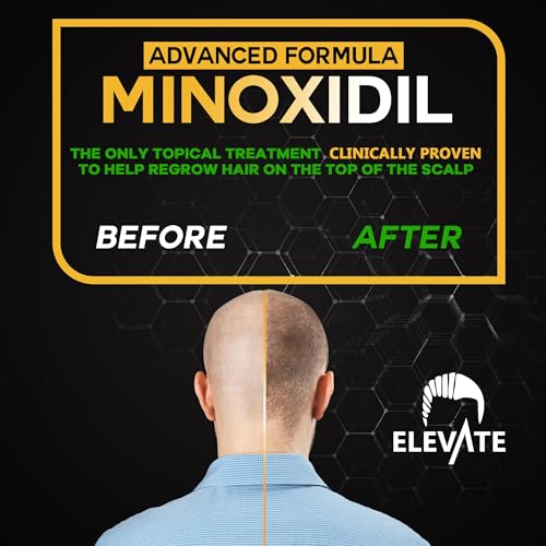 Elevate Hair Regrowth Treatment 5% Minoxidil Spray - Extra Strength Formula Professional Treatment for Hair Loss and Thinning for Regrowth - Stimulate Follicles for Men and Women 1 Month Supply